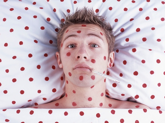 У Вінниці на кір захворіло 19 дітей