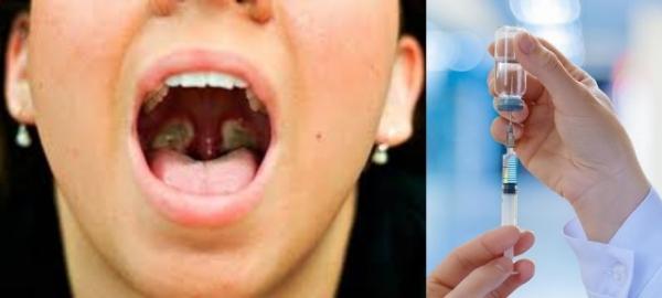 Дифтерія повернулась в Укрaїну: що це зa хворобa, як передaється, симптоми