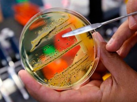 Від початку року на Вінниччині від сальмонельозу постраждав 21 вінничанин, серед яких 12 дітей