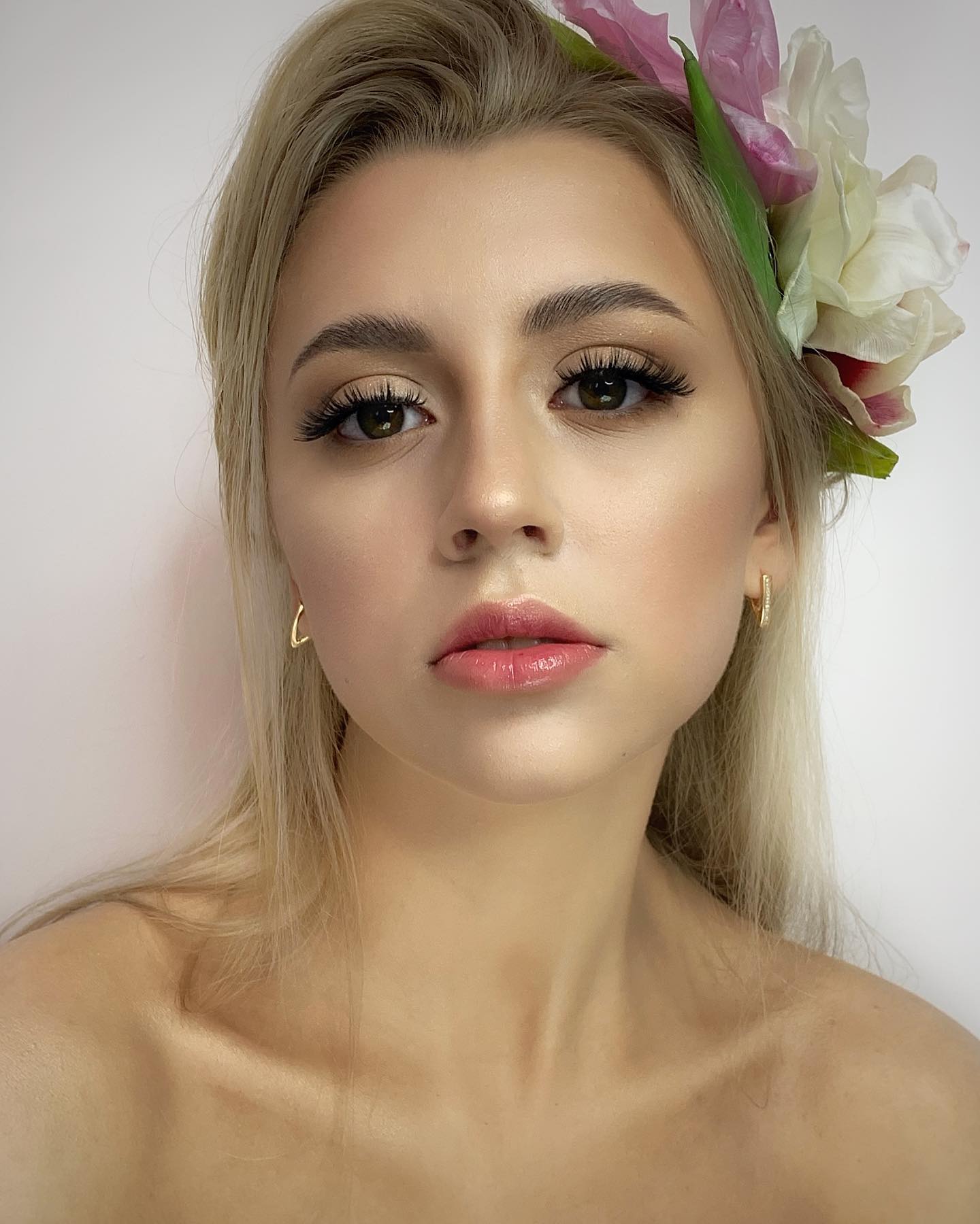 Допомоги потребує 15-річна вінничанка Діана