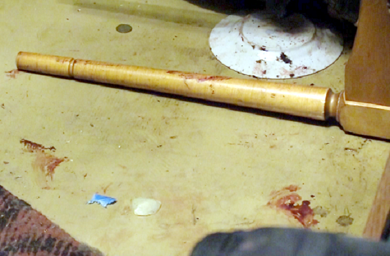 Киянин проломив голову своєму зятю (Фото)