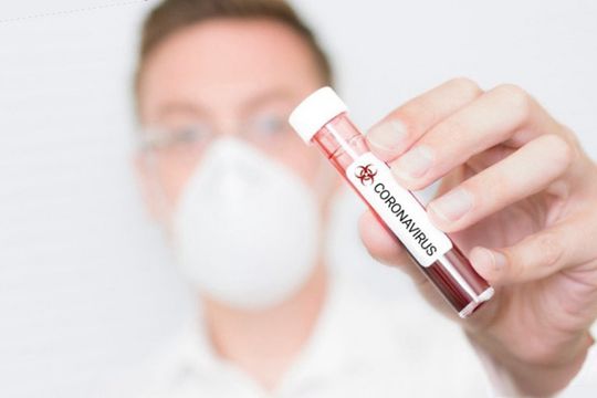 Вчені назвали симптоми того, що ви перехворіли на COVID-19 і не помітили