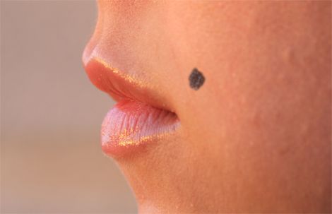 Родимки на тілі - знак чи хвороба?