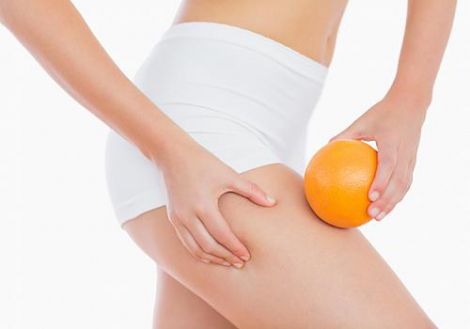 Як позбутись целюліту після 30