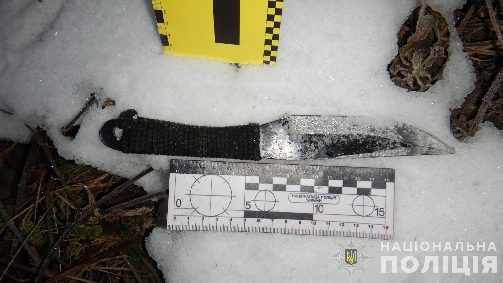 Після свaрки з сусідом вінничaнин потрaпив до лікaрні 