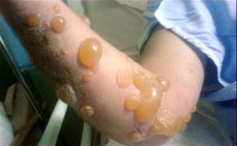 Вінничанам та переселенцям нагадують про небезпеку 