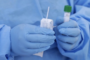 Степанов: російські ПЛР-тести використовують лише в приватних лабораторіях