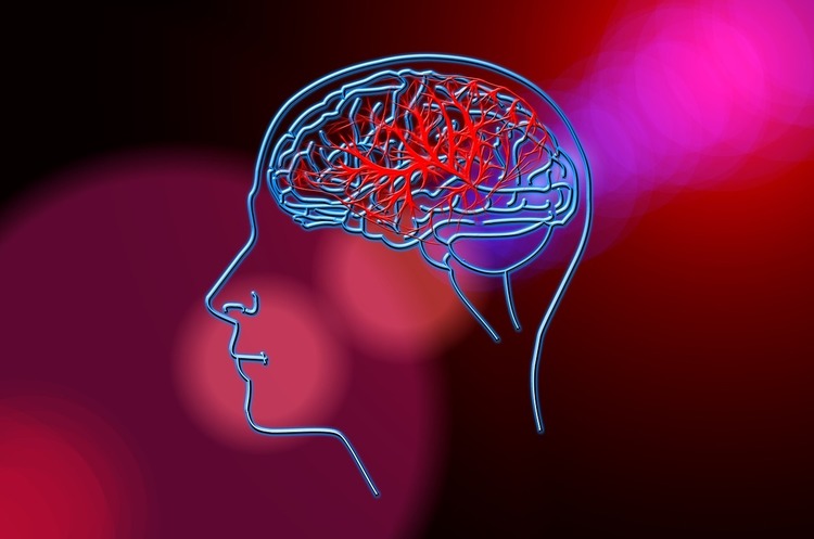 МОЗ напрацьовує Концепцію розвитку інсультної допомоги