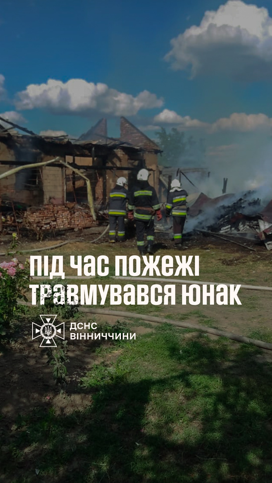 На Вінниччині хлопець отримав опіки під час пожежі