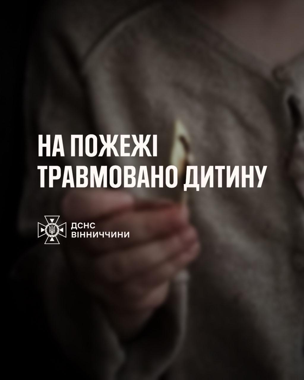 На Вінниччині дитячі пустощі з вогнем завершилися опіками