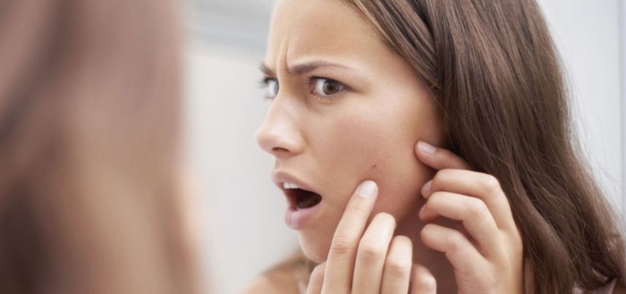 Названий головний продукт, який провокує прищі