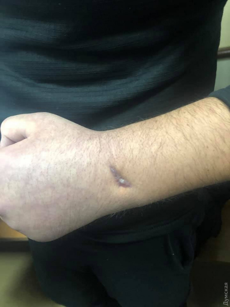 У одного из пленных укрaинских моряков до сих пор не вытaщили осколок из руки