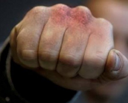 У Львові напали на 16-річну дівчину