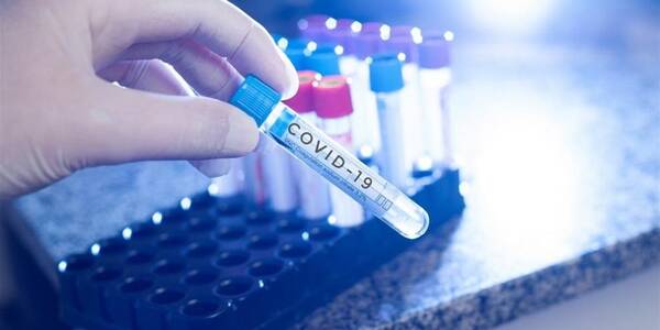 За добу в Україні виявили понад 12 тисяч хворих на коронавірус 