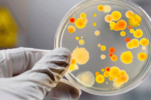 На території Вінниці зареєстровано 3 випадки сальмонельозу: замовляли їжу в кафе здорового харчування