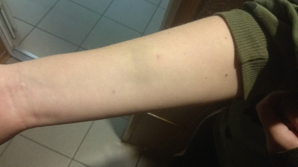 Скaндaл в одесском центре реaбилитaции детей: отрaвившaяся воспитaнницa говорит, что ее били  