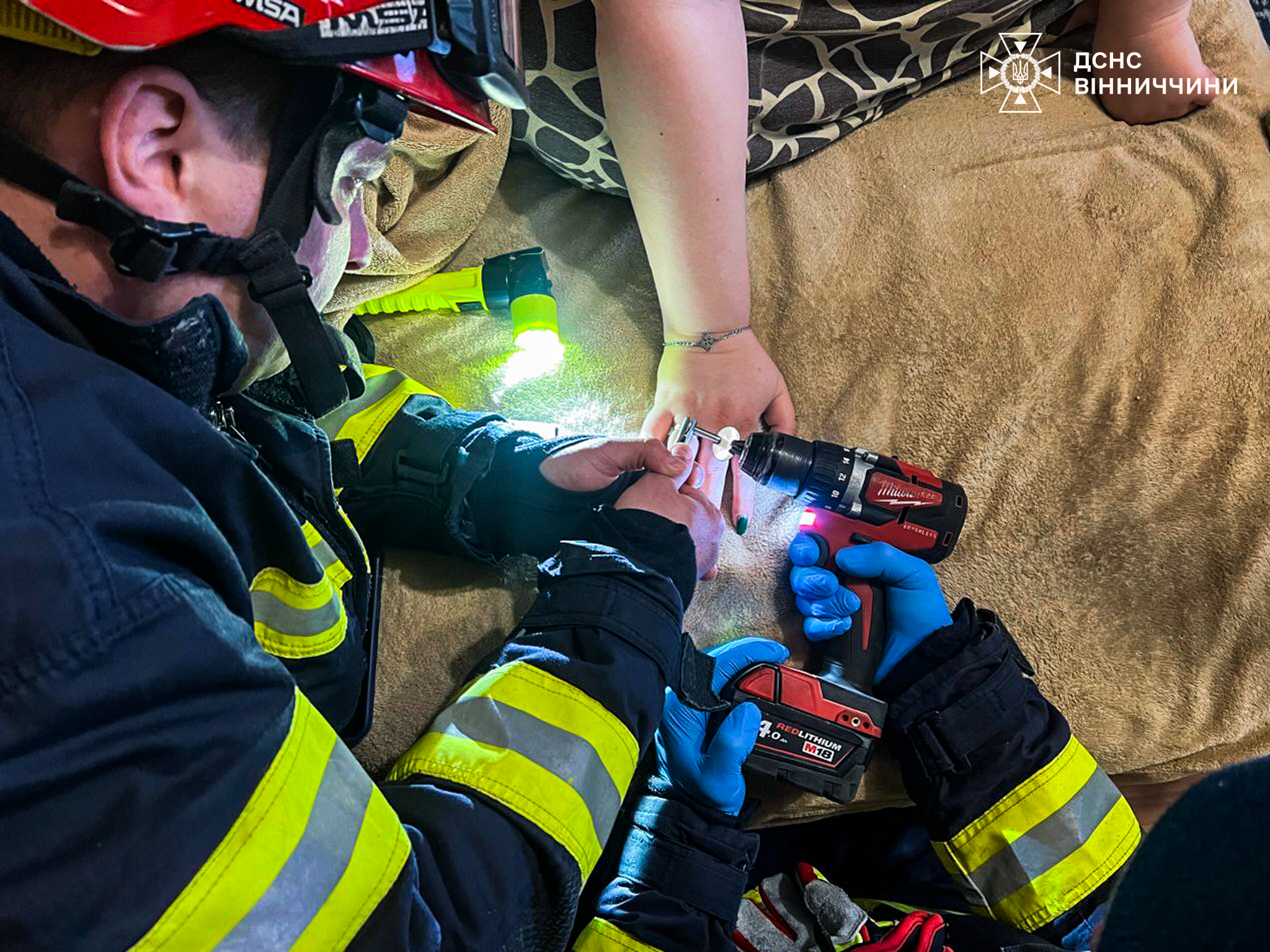 У Вінниці рятувальники допомогли жінці зняти обручку через набряк пальця