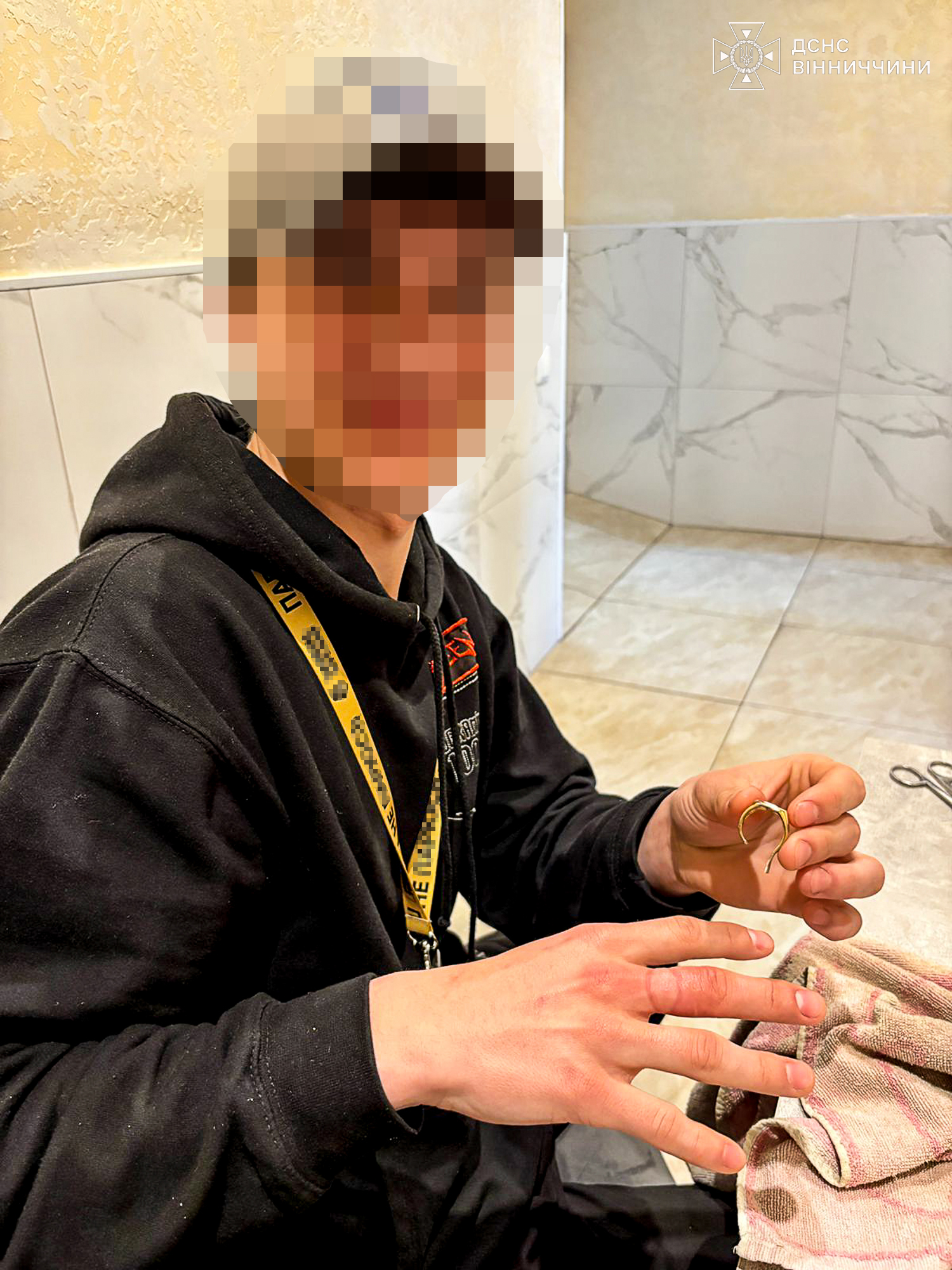 Перстень, що став пасткою: у Вінниці рятувальники допомогли хлопцю зняти небезпечну прикрасу