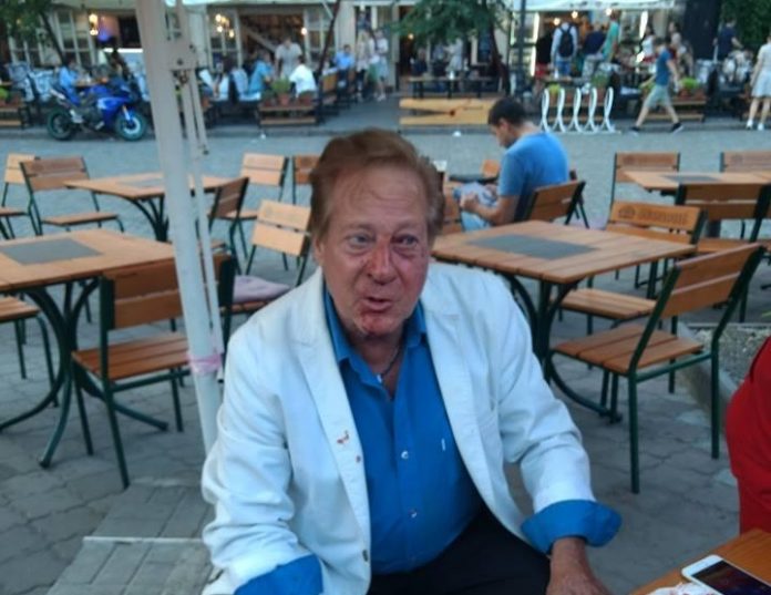 В Одесі побили відомого американського співака