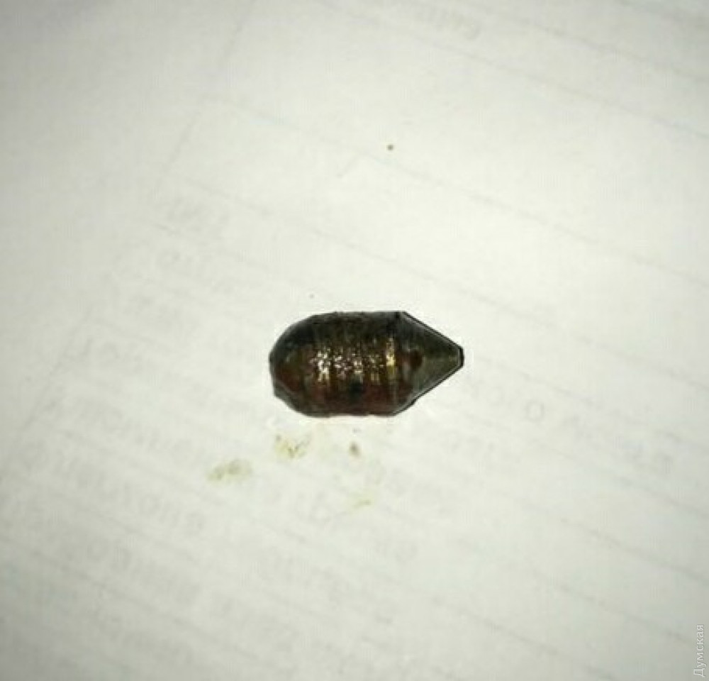 Из тела раненного на Новосельского капитана полиции извлекли последнюю самодельную пулю: говорят, они бронебойные