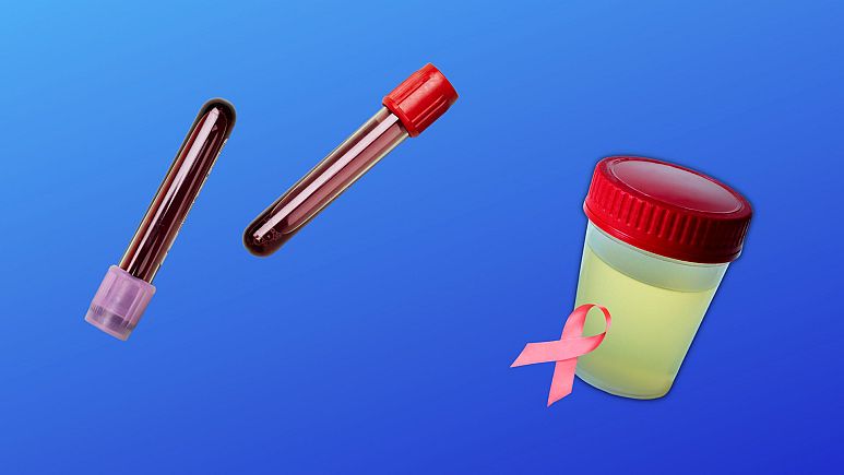 У Швеції розробили простий тест, який може виявити 14 різних типів раку