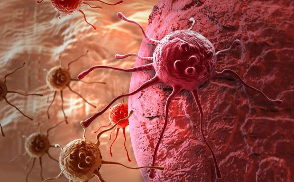 Вчені зупинили поширення раку, перетворивши онкоклітини на жир