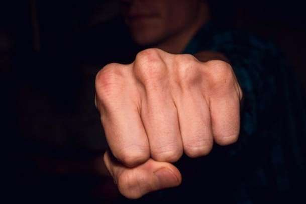 У Києві чоловіка жорстоко побили сусіди через те, що той гучно ввімкнув музику