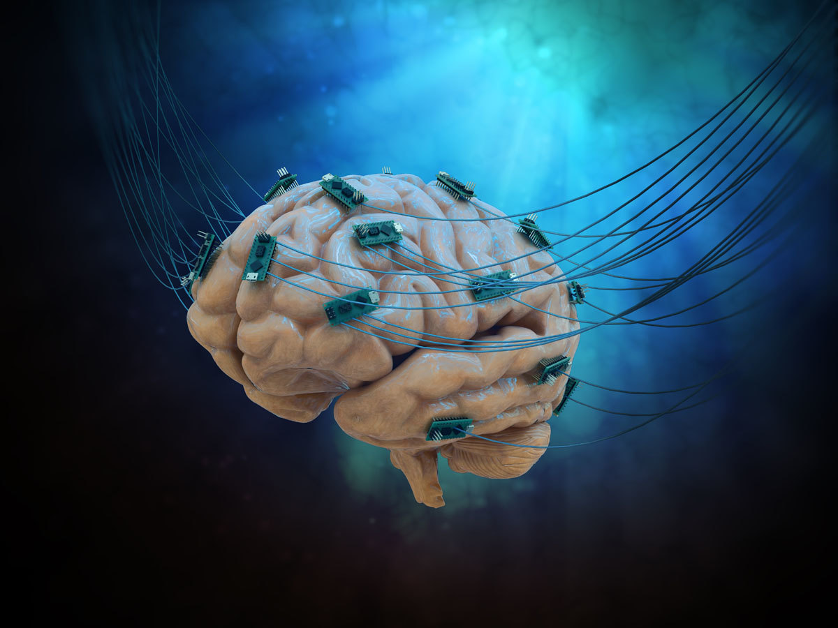 Стартап Synchron вперше вселив чіп у мозок людини
