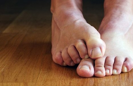 В Одесі босий чоловік примерз ногами до даху власного будинку