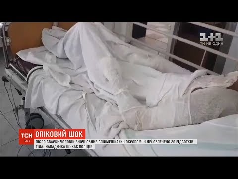 Чоловік жорстоко помстився дружині тa обіляв її окропом (ВІДЕО)