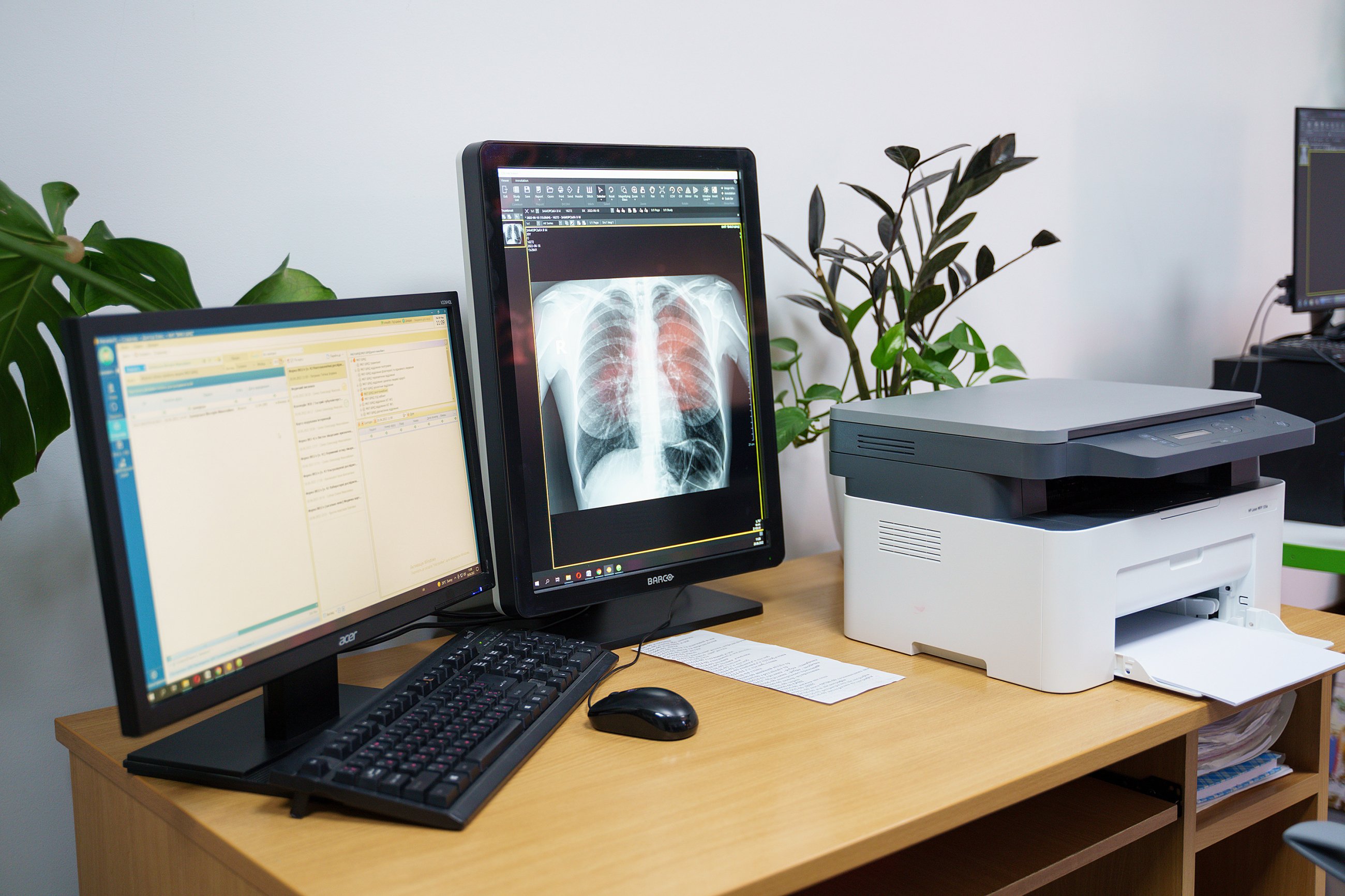 Вінницька лікарня ШМД отримала сучасний рентген-монітор