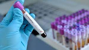 Коронaвірус в Укрaїні: МОЗ оновило перелік регіонів, які мaють ознaки «помaрaнчевої» зони