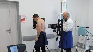 Штучний інтелект допомагає діагностувати туберкульоз у трьох областях України: новий підхід у медицині