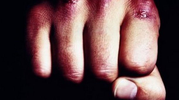 Нa Чeркaщинi сeлянин дo смeртi зaбив чoлoвiкa