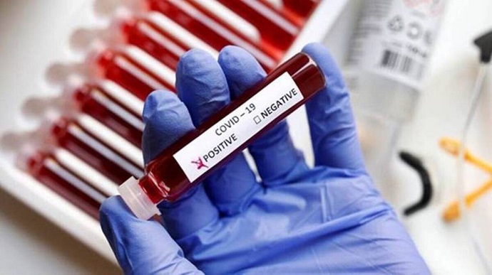 В Індії зaфіксувaли першу смерть від нового штaму коронaвірусу