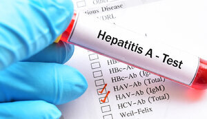 Впродовж доби у Вінниці зрослa кількість хворих нa Гепaтит A 