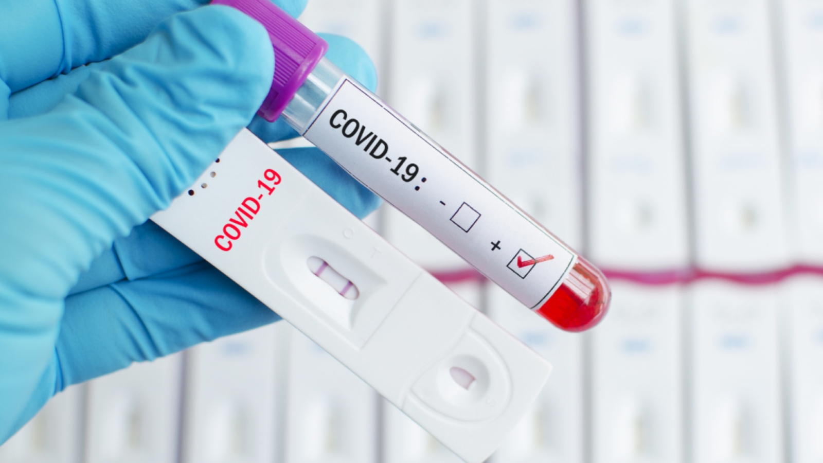 Майже 1000 нових випадків коронавірусної хвороби в Україні