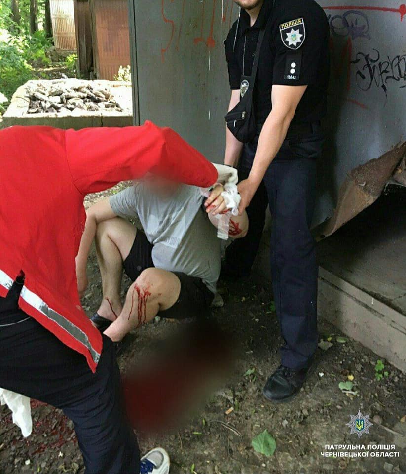 У Чернівцях чоловік порізав собі вени (ФОТО)