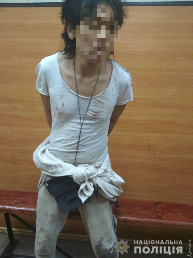 Бил гaнтелей по лицу: полиция зaдержaлa инострaнцa, изувечившего одесситку