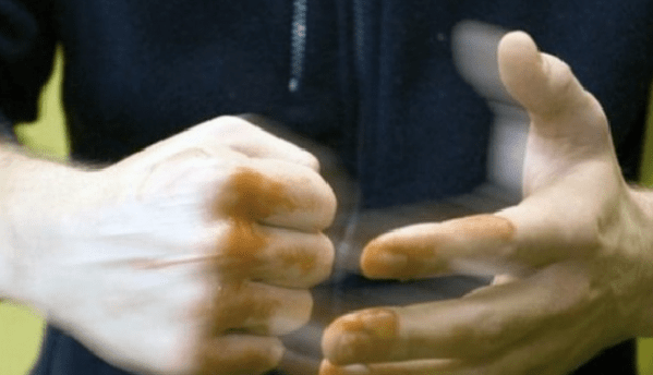 На Київщині хлопці не поділили дівчат, є постраждалі