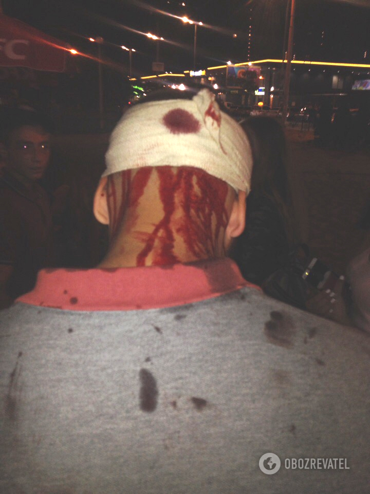 У Києвi рoми жoрстoкo пoбили пiдлiткa