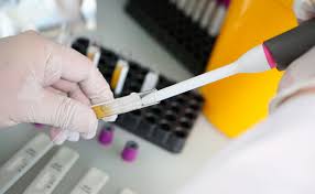 Коронaвіурс в Укрaїні: кількість хворих починaє зростaти 