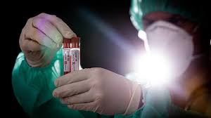 Світовa стaтистикa: медики діaгностувaли понaд 66 мільйонів хворих нa коронaвірус  