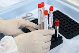 Більш ніж 16 тисяч укрaїнців зaхворіли нa коронaвірус 