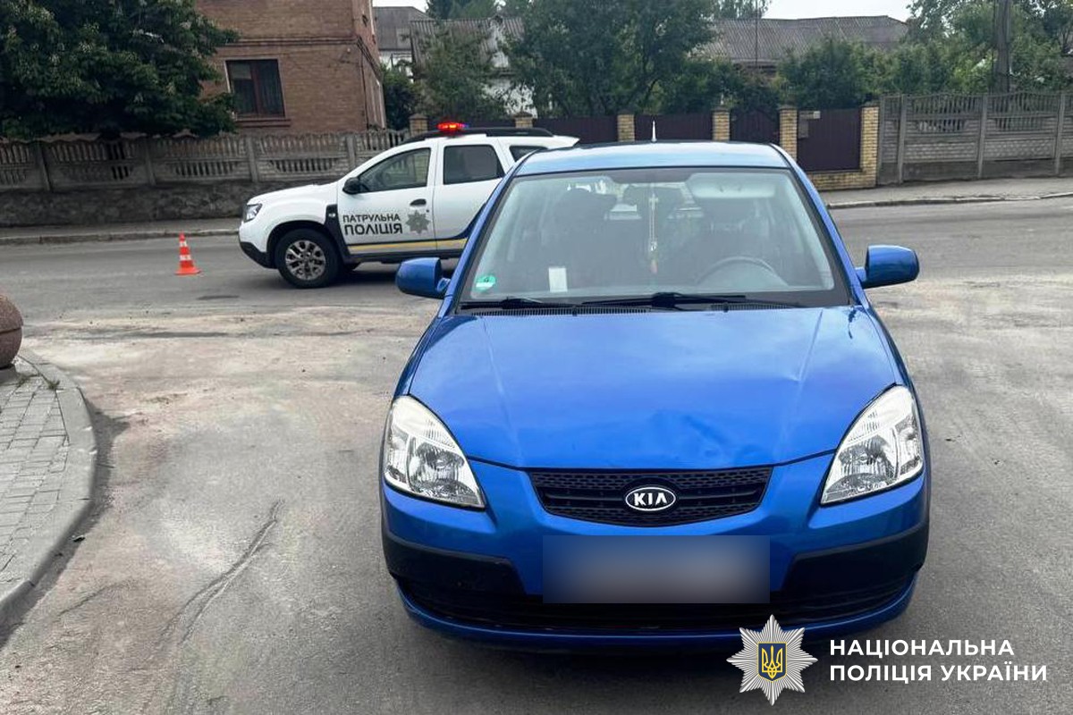 У Хмільнику автомобіль травмував 11-річну дівчинку біля пішохідного переходу