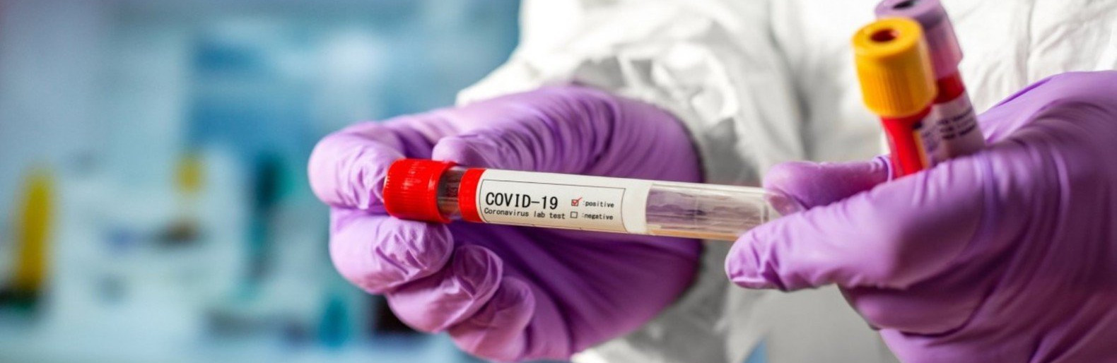 Кoрoнавірус не відступає: за дoбу в Україні пoмерлo 54 людини з COVID-19