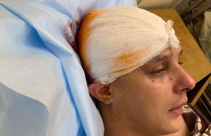 ​​У Києві побили музичного продюсера гурту KAZKA: поліцейські затримали нападника