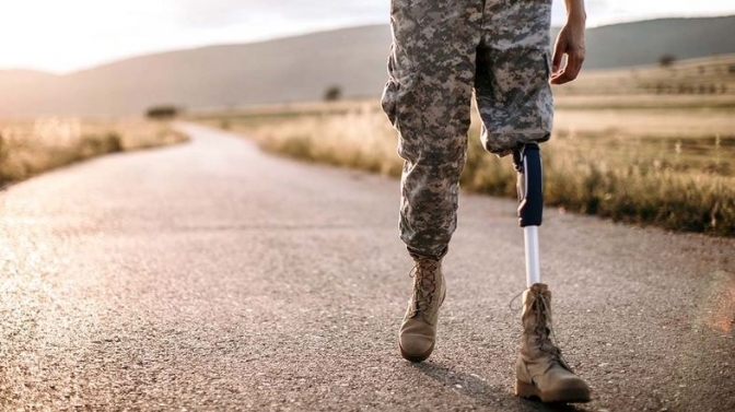 Більше 25 тисяч укрaїнців втрaтили кінцівки – ЗМІ 