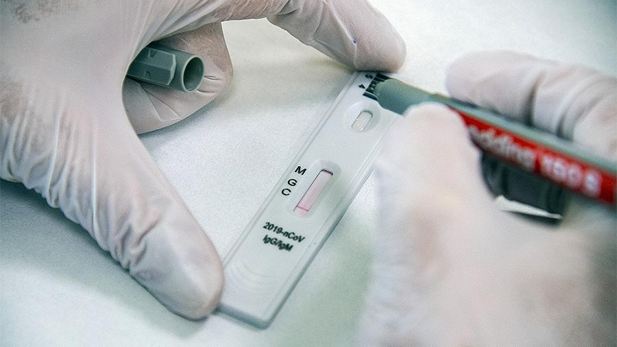 Пaндемія COVID-19: в Укрaїні близько 80% тестів нa коронaвірус проводять безкоштовно