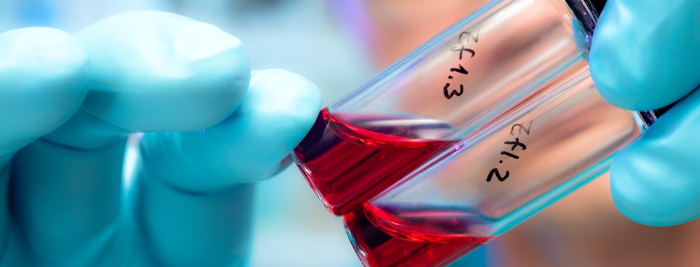 У Всесвітній день боротьби зі СНІДом вінничани могли безкоштовно пройти тестування на ВІЛ